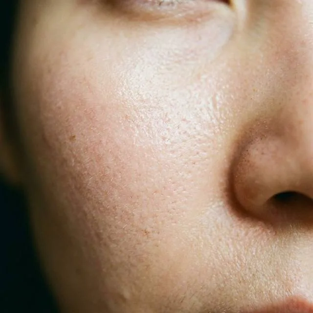 Pores & Oil